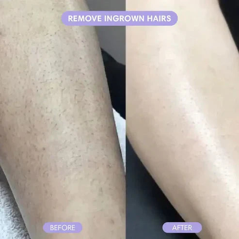 Crystal Hair Remover