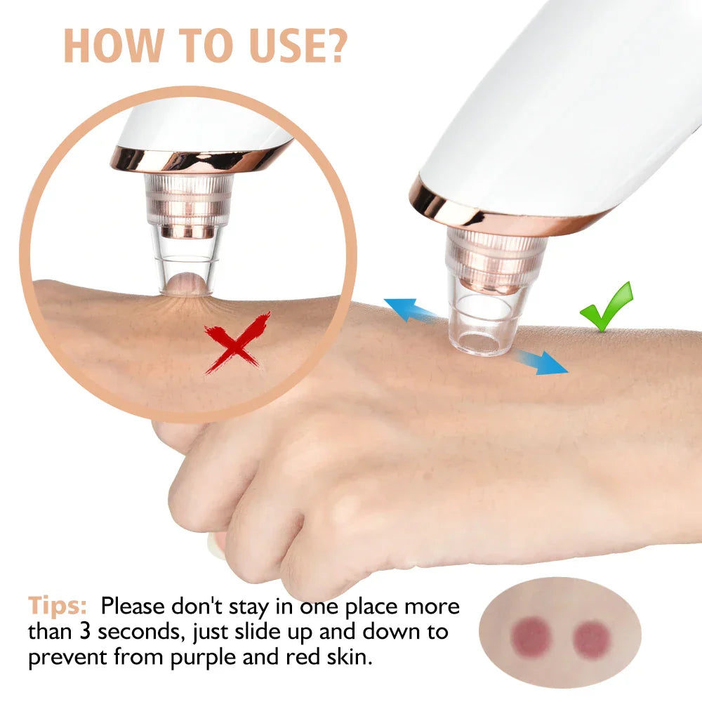 Acne Pore Cleaner & Black Head Remover With Cleaning Tools